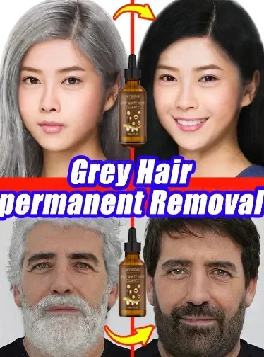 YH03 White Hair Killer White To Black HairAnti-grey Hair Essence Serum Treatment Restore Natural Hair Color and Restore Healthy