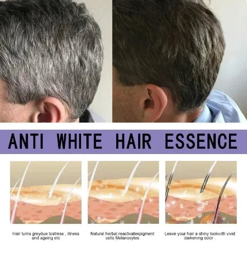 YH03 White Hair Killer White To Black HairAnti-grey Hair Essence Serum Treatment Restore Natural Hair Color and Restore Healthy