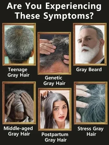 YH03 White Hair Killer White To Black HairAnti-grey Hair Essence Serum Treatment Restore Natural Hair Color and Restore Healthy